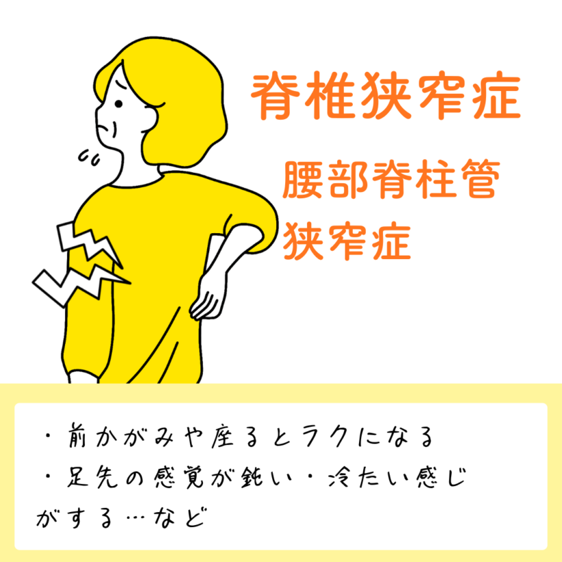 脊椎狭窄症（腰部脊柱管狭窄症）